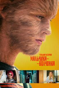 Реальная история мальчика-волчонка
